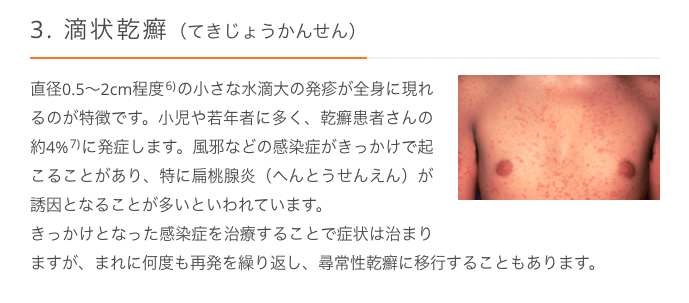 滴状乾癬