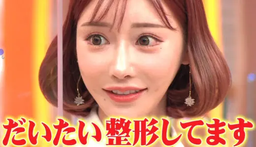 【整形モンスター】明日花キララは整形中毒で費用は1000万円超えだった！？変わりすぎててエグいwww